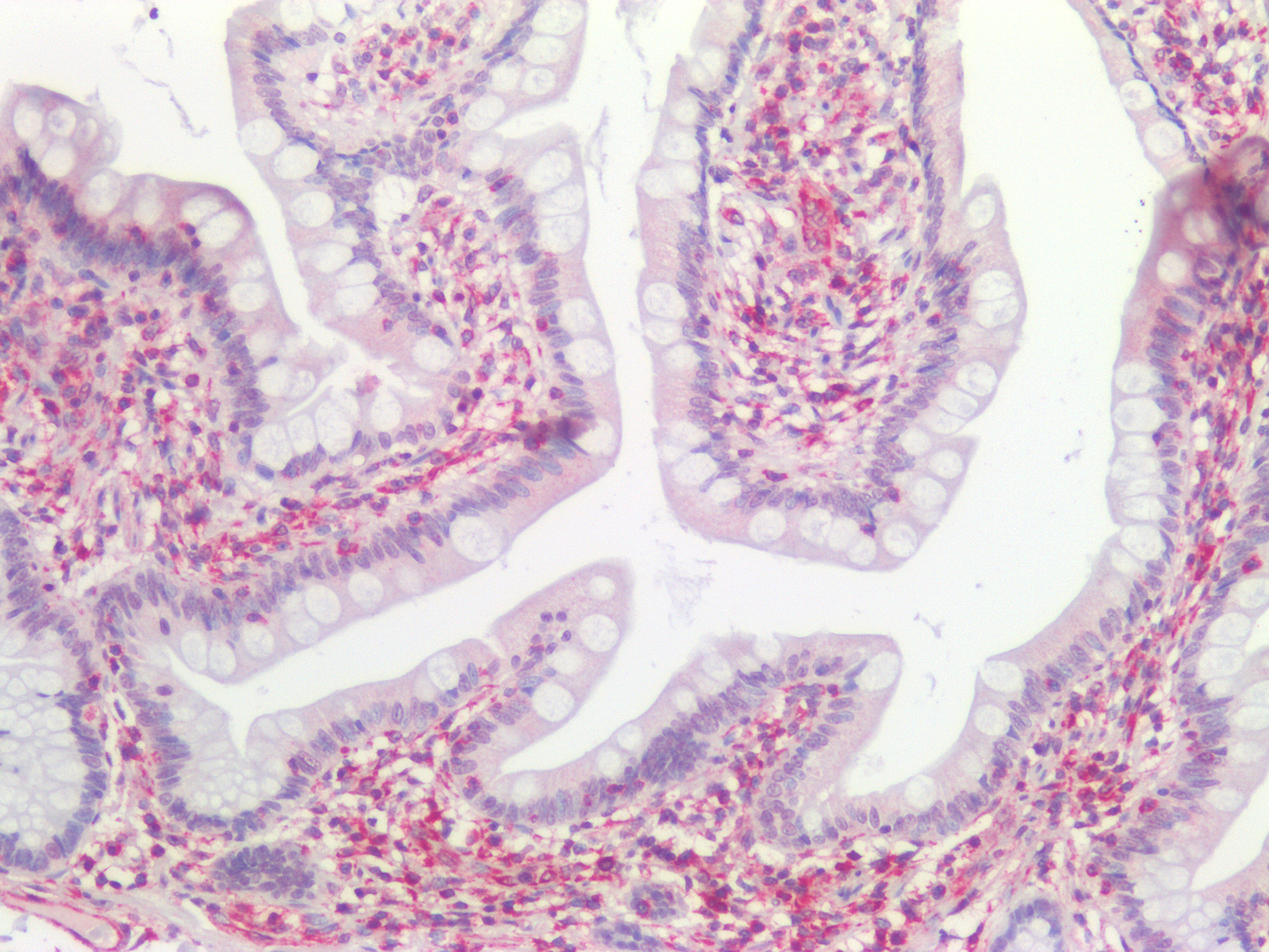 Figure 10. Immunohistochemistry on formalin fixed, paraffin embedded section of human small intestine showing positive staining in connective tissue cells and no reactivity in epithelial cells.